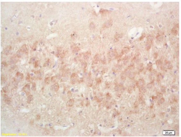 Immunohistochemistry (Formalin/PFA-fixed paraffin-embedded sections) - Anti-PR3 antibody (AB202968)