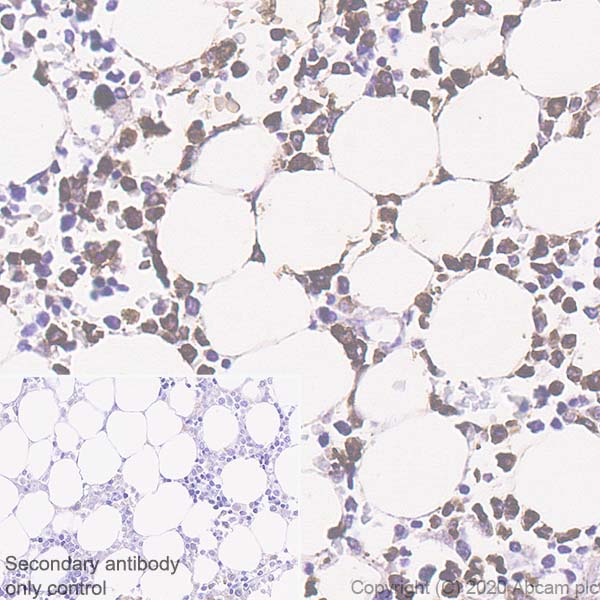 Anti-PR3 antibody [EPR23253-35]