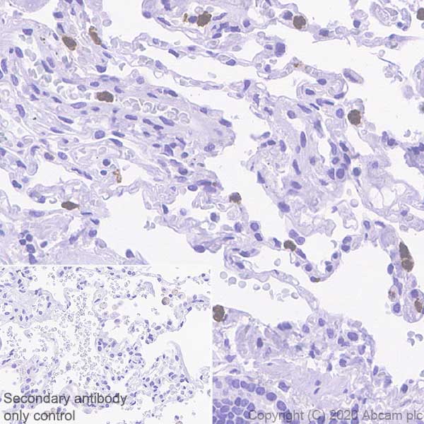 Immunohistochemistry (Formalin/PFA-fixed paraffin-embedded sections) - Anti-PR3 antibody [EPR23253-35] (AB270441)