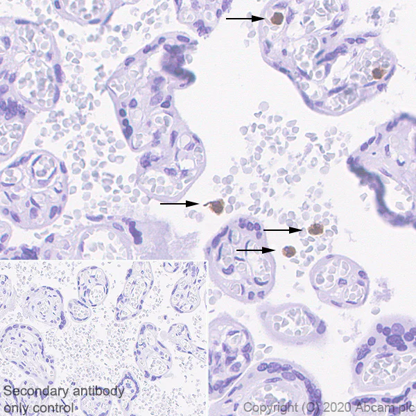 Immunohistochemistry (Formalin/PFA-fixed paraffin-embedded sections) - Anti-PR3 antibody [EPR23253-35] - BSA and Azide free (AB270610)