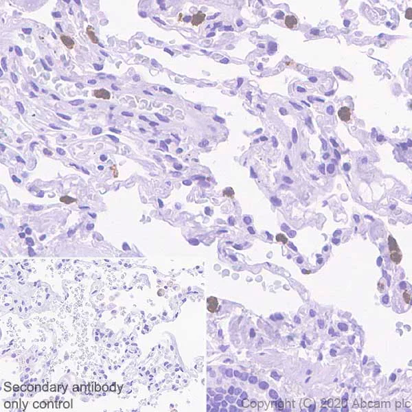 Immunohistochemistry (Formalin/PFA-fixed paraffin-embedded sections) - Anti-PR3 antibody [EPR23253-35] - BSA and Azide free (AB270610)
