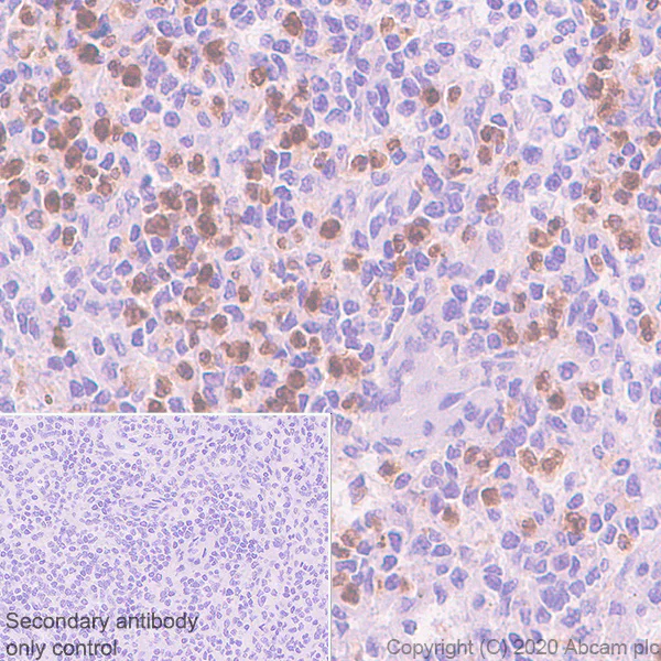 Immunohistochemistry (Formalin/PFA-fixed paraffin-embedded sections) - Anti-PR3 antibody [EPR23253-35] - BSA and Azide free (AB270610)