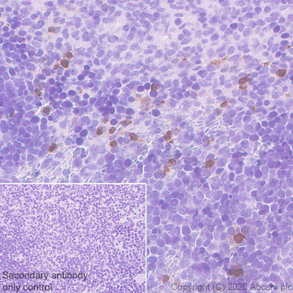 Immunohistochemistry (Formalin/PFA-fixed paraffin-embedded sections) - Anti-PR3 antibody [EPR23253-35] - BSA and Azide free (AB270610)