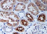 Immunohistochemistry (Formalin/PFA-fixed paraffin-embedded sections) - Anti-PR3 antibody [EPR6277] (AB133613)
