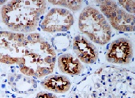 Immunohistochemistry (Formalin/PFA-fixed paraffin-embedded sections) - Anti-PR3 antibody [EPR6277] - BSA and Azide free (AB248577)