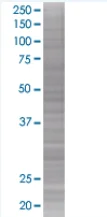 SDS-PAGE - PR3 overexpression 293T lysate (whole cell) (AB94310)