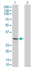 Western blot - PR3 overexpression 293T lysate (whole cell) (AB94310)
