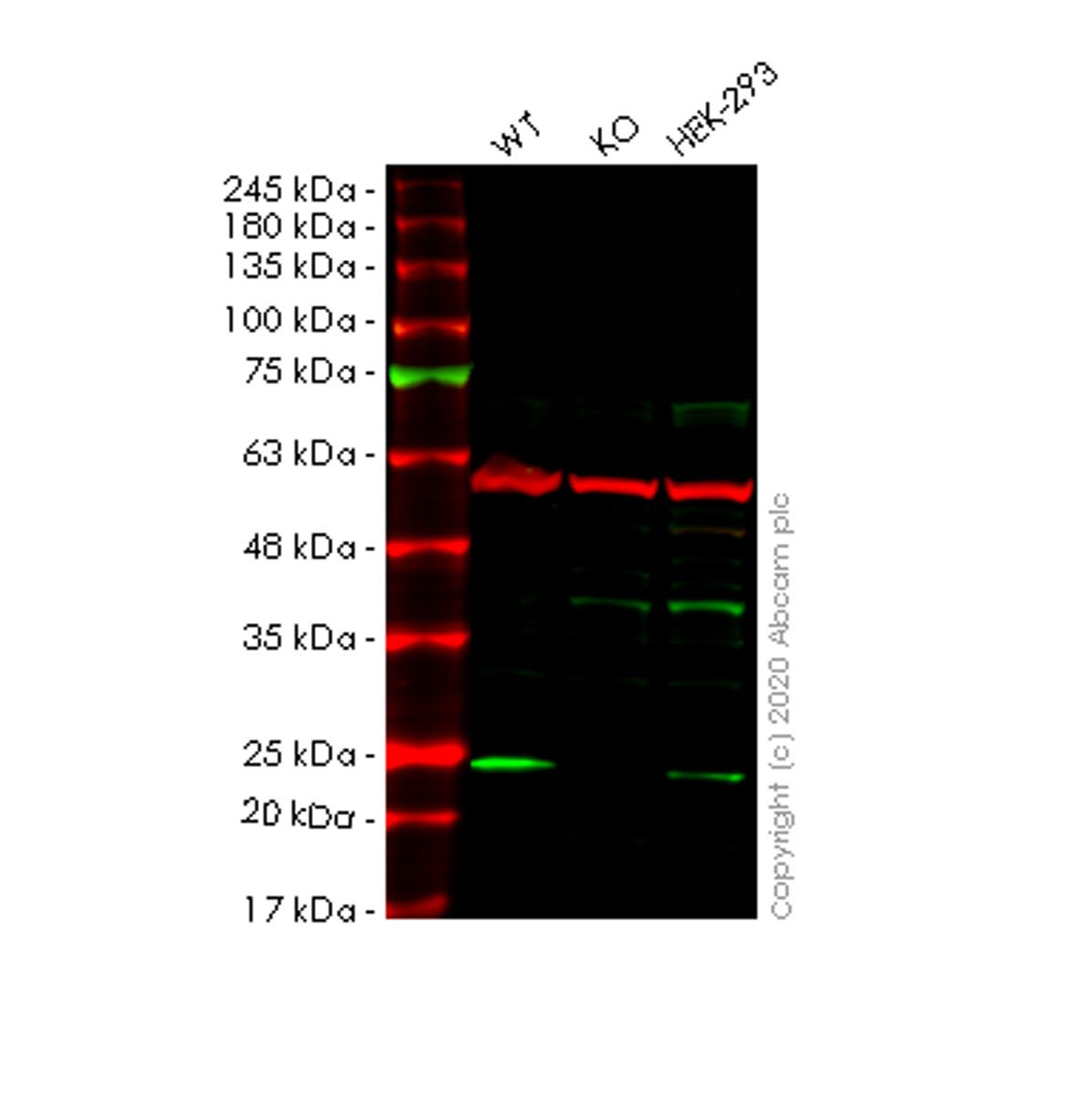 Western blot - Anti-PRA1 antibody [EPR1747Y] (AB76413), expandable thumbnail