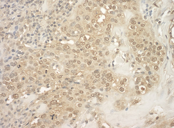 Immunohistochemistry (Formalin/PFA-fixed paraffin-embedded sections) - Anti-PRAK/MK5 antibody (AB93800), expandable thumbnail