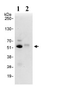 Immunoprecipitation - Anti-PRAK/MK5 antibody (AB93800), expandable thumbnail