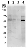 Western blot - Anti-PRAK/MK5 antibody (AB93800)