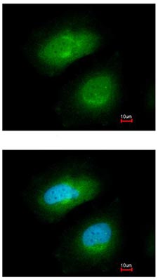 Immunocytochemistry/ Immunofluorescence - Anti-PRAK/MK5 antibody (AB97332)