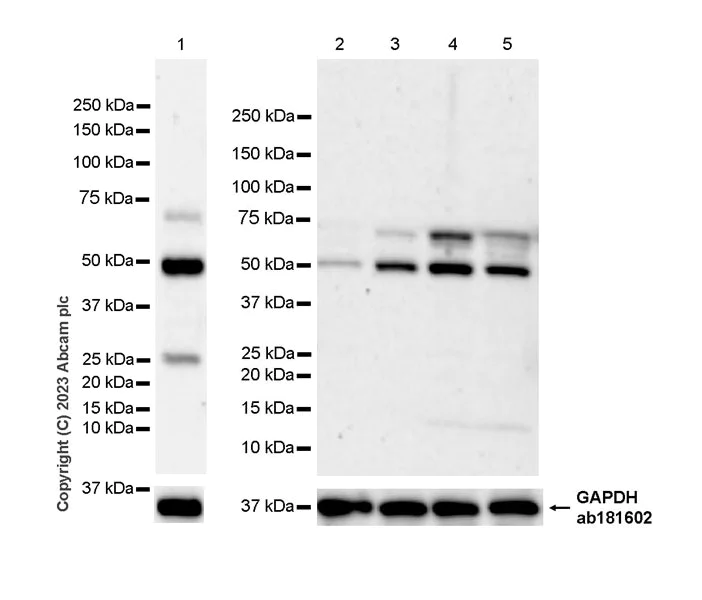 Western blot - Anti-PRAK/MK5 antibody [EPR26844-237] (AB309533)