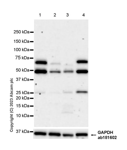 Western blot - Anti-PRAK/MK5 antibody [EPR26844-237] (AB309533)
