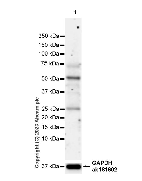 Western blot - Anti-PRAK/MK5 antibody [EPR26844-237] (AB309533), expandable thumbnail