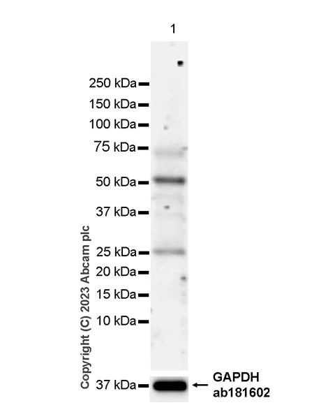 Western blot - Anti-PRAK/MK5 antibody [EPR26844-237] (AB309533)