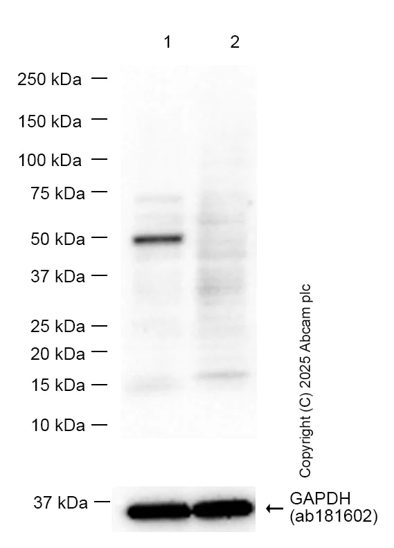 Western blot - Anti-PRAK/MK5 antibody [EPR26844-237] (AB309533)
