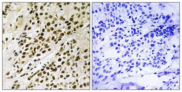 Immunohistochemistry (Formalin/PFA-fixed paraffin-embedded sections) - Anti-PRAK/MK5 (phospho T182) antibody (AB138668)