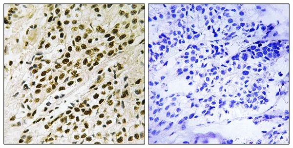 Immunohistochemistry (Formalin/PFA-fixed paraffin-embedded sections) - Anti-PRAK/MK5 (phospho T182) antibody (AB138668)