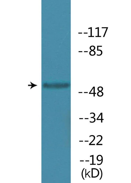 Western blot - Anti-PRAK/MK5 (phospho T182) antibody (AB138668)