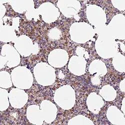 Immunohistochemistry (Formalin/PFA-fixed paraffin-embedded sections) - Anti-PRAM1 antibody (AB151092)