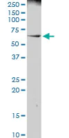 Western blot - Anti-PRAME antibody (AB89097)