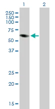 Western blot - Anti-PRAME antibody (AB89097)