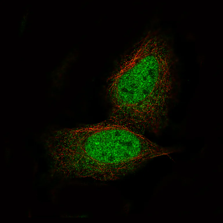 Immunocytochemistry/ Immunofluorescence - Anti-PRAME Antibody [CL5146] (AB327117)