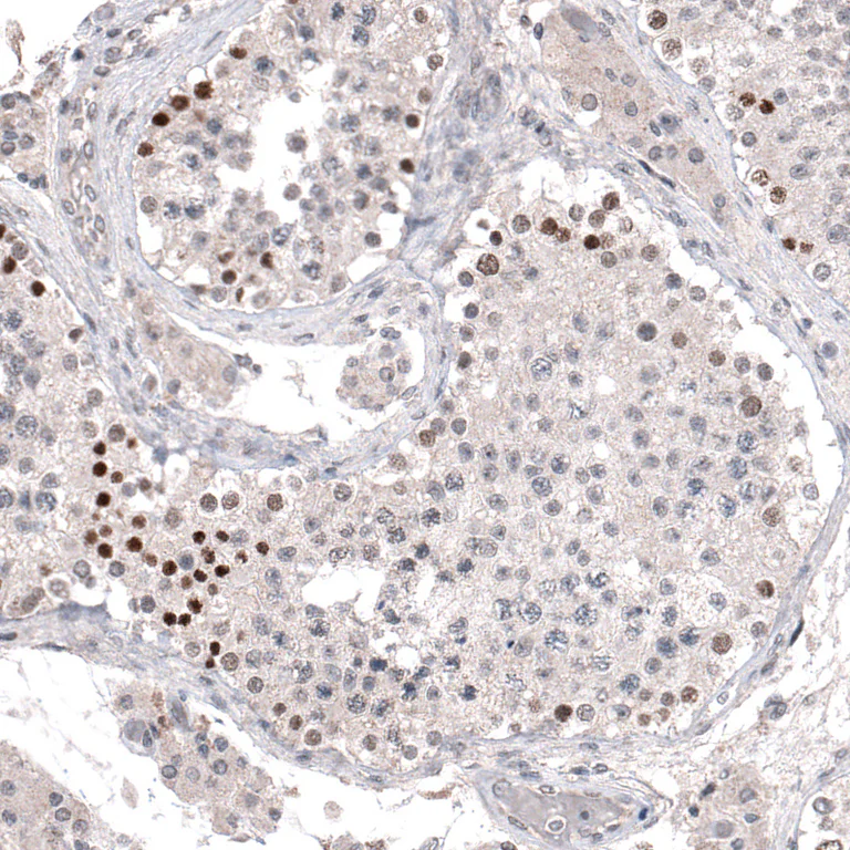 Immunohistochemistry (Formalin/PFA-fixed paraffin-embedded sections) - Anti-PRAME Antibody [CL5148] (AB327118)