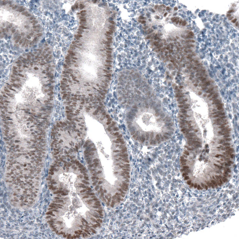 Immunohistochemistry (Formalin/PFA-fixed paraffin-embedded sections) - Anti-PRAME Antibody [CL5148] (AB327118)