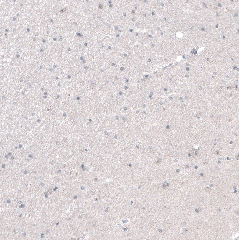 Immunohistochemistry (Formalin/PFA-fixed paraffin-embedded sections) - Anti-PRAME Antibody [CL5148] (AB327118)
