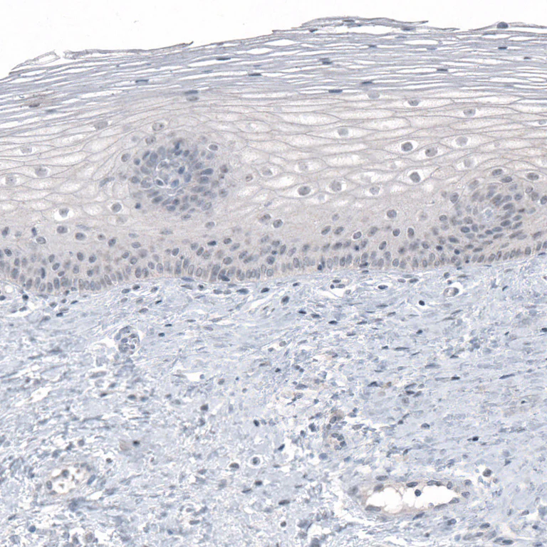 Immunohistochemistry (Formalin/PFA-fixed paraffin-embedded sections) - Anti-PRAME Antibody [CL5148] (AB327118)