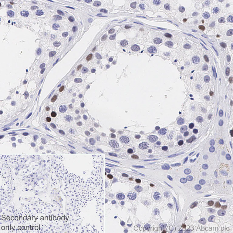 Immunohistochemistry (Formalin/PFA-fixed paraffin-embedded sections) - Anti-PRAME antibody [EPR20330] (AB219650)