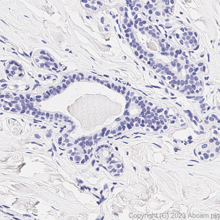 Immunohistochemistry (Formalin/PFA-fixed paraffin-embedded sections) - Anti-PRAME antibody [EPR20330] (AB219650)