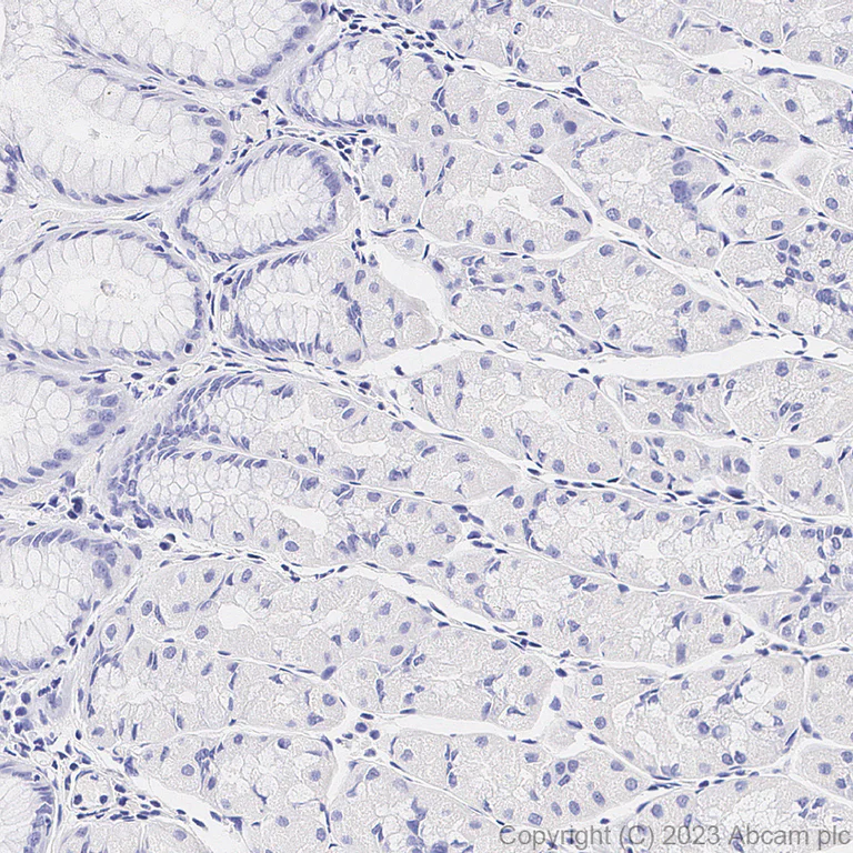 Immunohistochemistry (Formalin/PFA-fixed paraffin-embedded sections) - Anti-PRAME antibody [EPR20330] (AB219650)