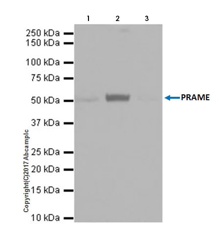 Immunoprecipitation - Anti-PRAME antibody [EPR20330] (AB219650)