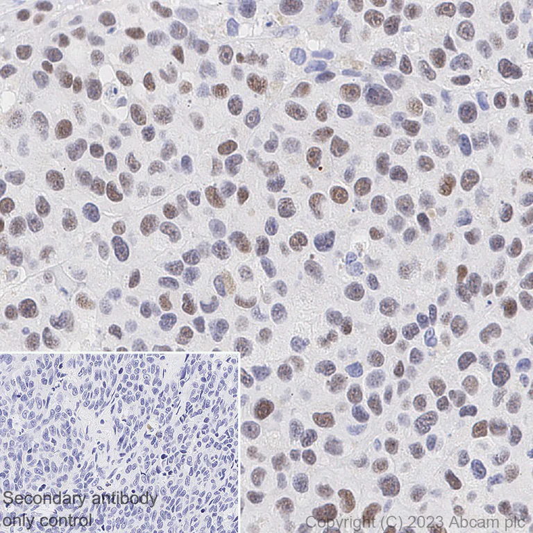 Immunohistochemistry (Formalin/PFA-fixed paraffin-embedded sections) - Anti-PRAME antibody [EPR20330] - BSA and Azide free (AB232571)