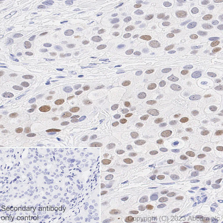 Immunohistochemistry (Formalin/PFA-fixed paraffin-embedded sections) - Anti-PRAME antibody [EPR20330] - BSA and Azide free (AB232571)
