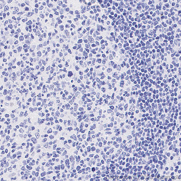 Immunohistochemistry (Formalin/PFA-fixed paraffin-embedded sections) - Anti-PRAME antibody [EPR20330] - BSA and Azide free (AB232571)