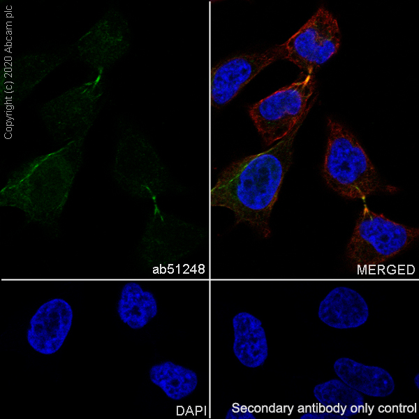 Immunocytochemistry/ Immunofluorescence - Anti-PRC1 antibody [EP1513Y] (AB51248), expandable thumbnail