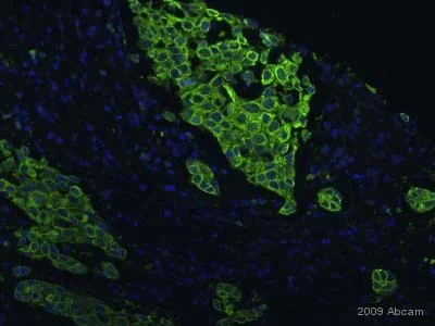 Immunocytochemistry/ Immunofluorescence - Anti-PRC1 antibody [EP1513Y] - BSA and Azide free (AB238427)