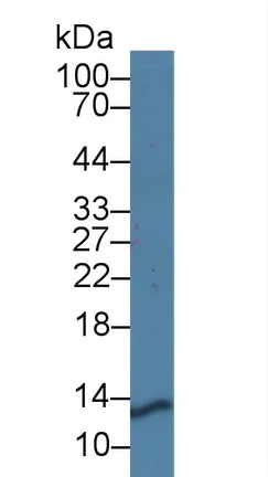 Western blot - Anti-PRCP antibody (AB231526)