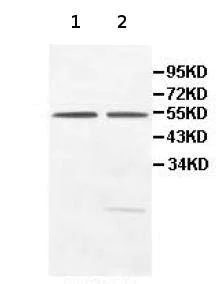 Western blot - Anti-PRD antibody (AB111851)