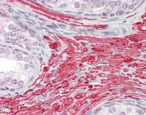 Immunohistochemistry (Formalin/PFA-fixed paraffin-embedded sections) - Anti-PRDC antibody - C-terminal (AB228736)