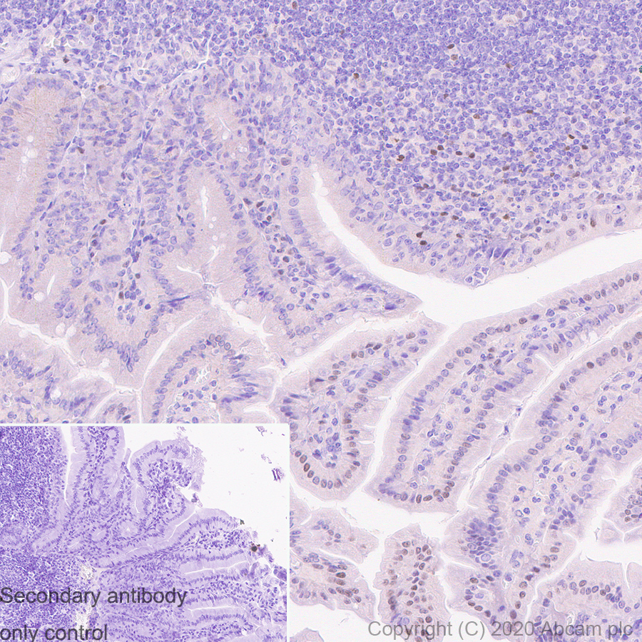 Immunohistochemistry (Formalin/PFA-fixed paraffin-embedded sections) - Anti-PRDM1/Blimp1 antibody [6D3] (AB243146), expandable thumbnail