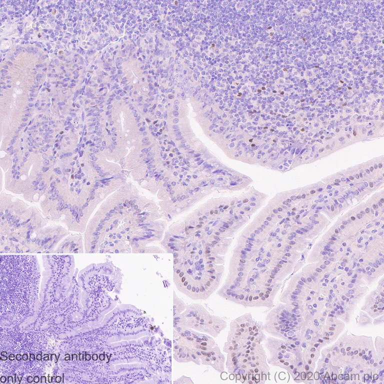 Immunohistochemistry (Formalin/PFA-fixed paraffin-embedded sections) - Anti-PRDM1/Blimp1 antibody [6D3] - BSA and Azide free (AB252242)