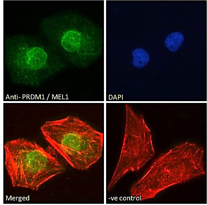Immunocytochemistry/ Immunofluorescence - Anti-PRDM1/Blimp1 antibody (AB106766)