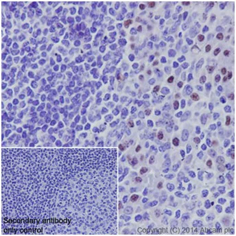 Immunohistochemistry (Formalin/PFA-fixed paraffin-embedded sections) - Anti-PRDM1/Blimp1 antibody [EPR16655] (AB198287)