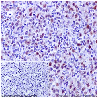 Immunohistochemistry (Formalin/PFA-fixed paraffin-embedded sections) - Anti-PRDM1/Blimp1 antibody [EPR16655] - BSA and Azide free (AB240344), expandable thumbnail