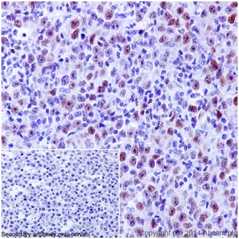 Immunohistochemistry (Formalin/PFA-fixed paraffin-embedded sections) - Anti-PRDM1/Blimp1 antibody [EPR16655] - BSA and Azide free (AB240344)